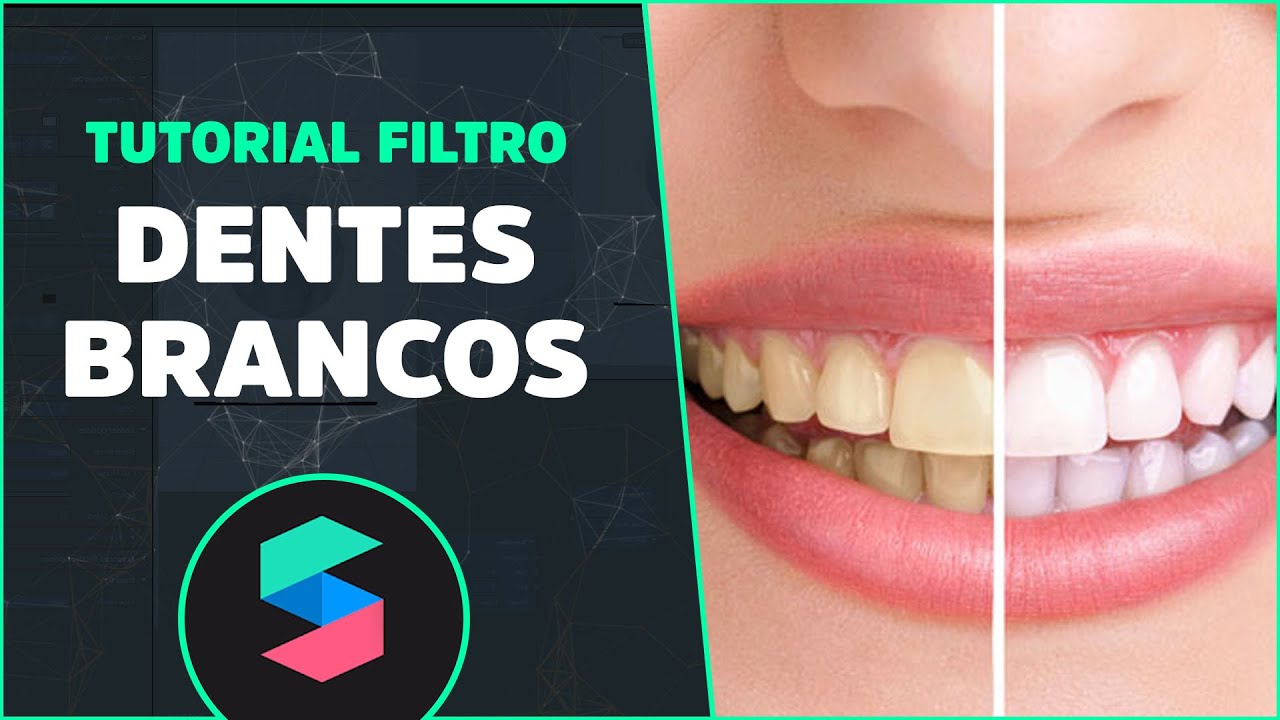 Dentes brancos nos seus filtros - Spark Ar