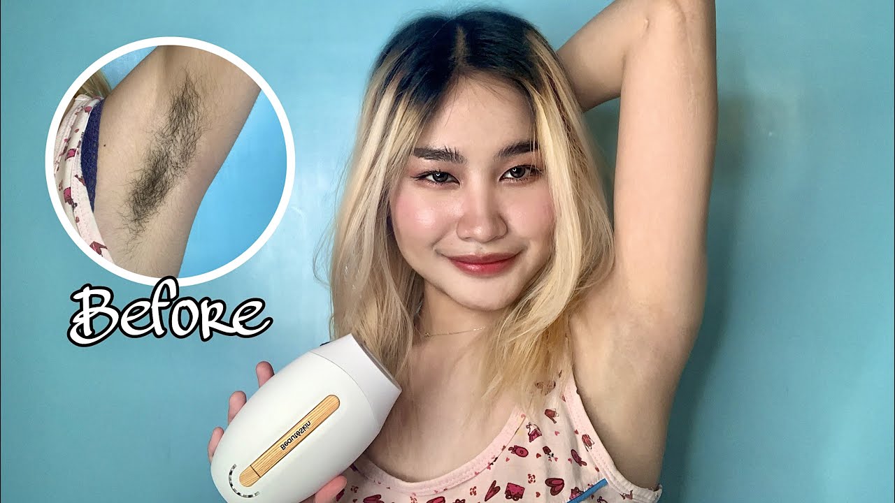 DIY KILI KILI PERMANENT HAIR REMOVAL AT HOME! (IPL) | Philippines