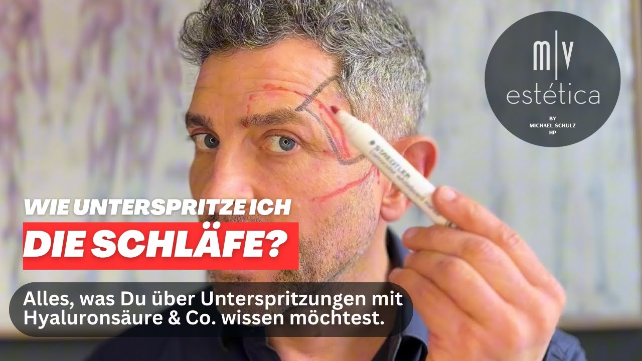 Schl&auml;fe:  Unterspritzung mit Hyaluron. 3 Techniken leicht verst&auml;ndlich erkl&auml;rt.