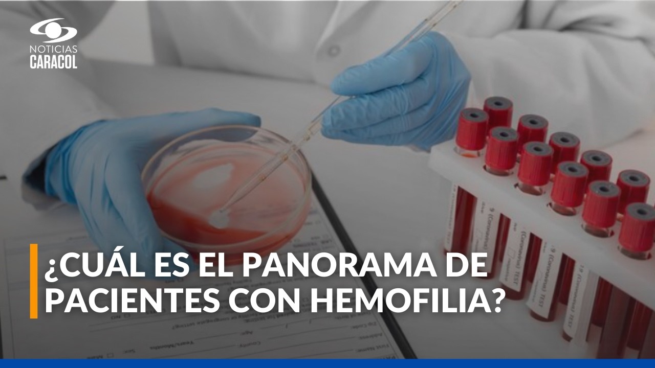 ¿Qué es la hemofilia?: Los riesgos de no recibir el medicamento tratante a tiempo