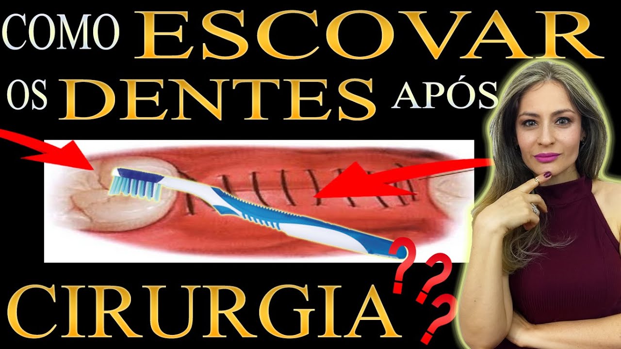 🟢КАК ЧИСТИТЬ ЗУБЫ ПОСЛЕ ОПЕРАЦИИ? Нужно ли чистить зубы ...