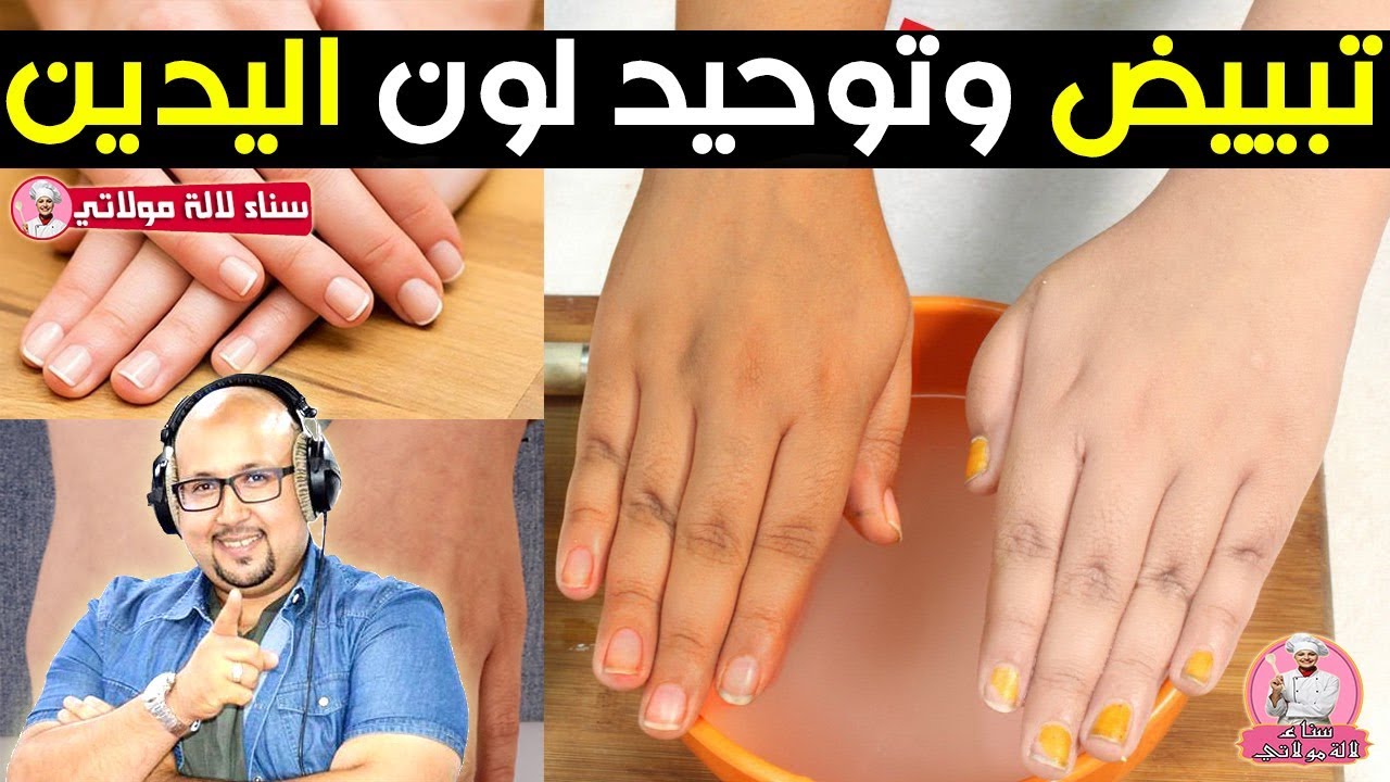 وصفة طبيعية بمكونين لتبييض اليدين وتوحيد لونهما - الدكتور عماد ميزاب Dr imad mizab