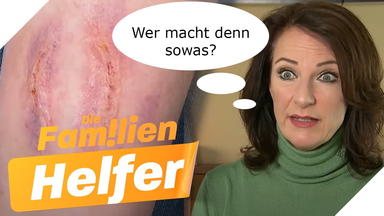 Vom Menschen gebissen worden?! Wer tut Annika (16) sowas an? | Die Familienhelfer | SAT.1