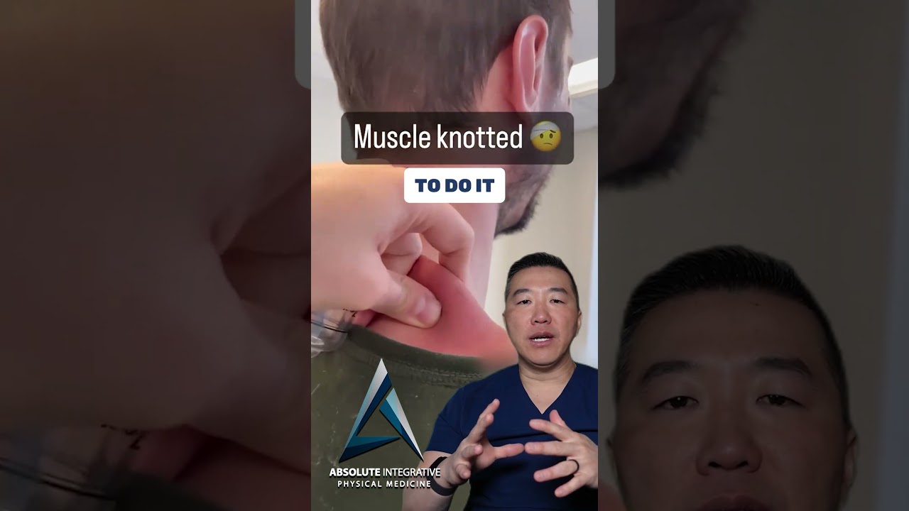 Acupuncture & Muscle Knots&mdash;What&rsquo;s the Deal? 🎯