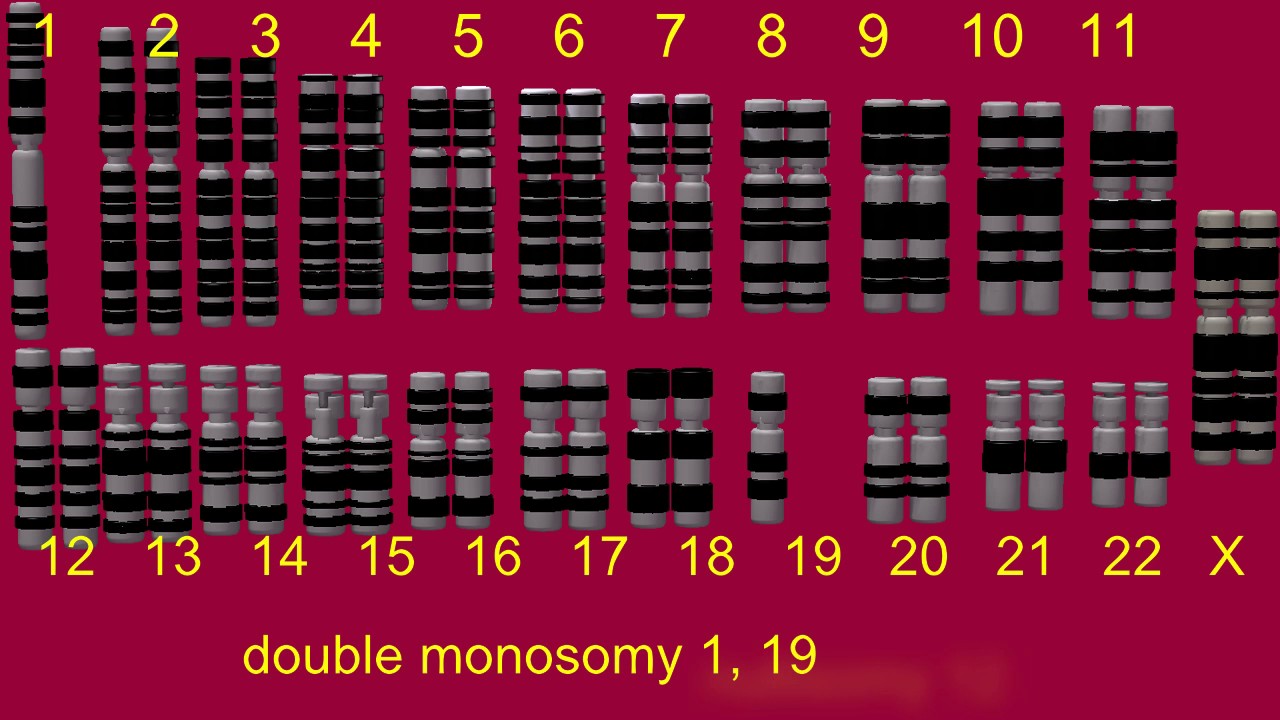 MONOSOMY, DOUBLE MONOSOMY, NULLISOMY