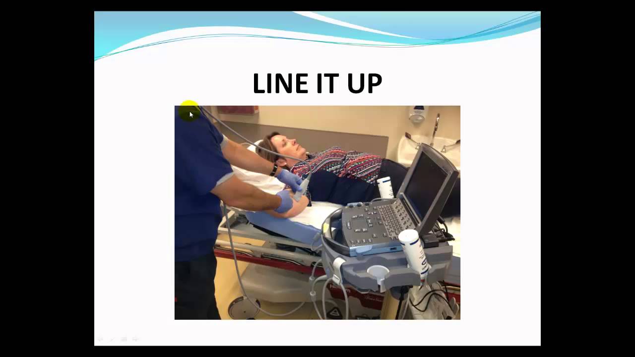 ultrasound guided  peripheral IV  course  by Siegfried Emme