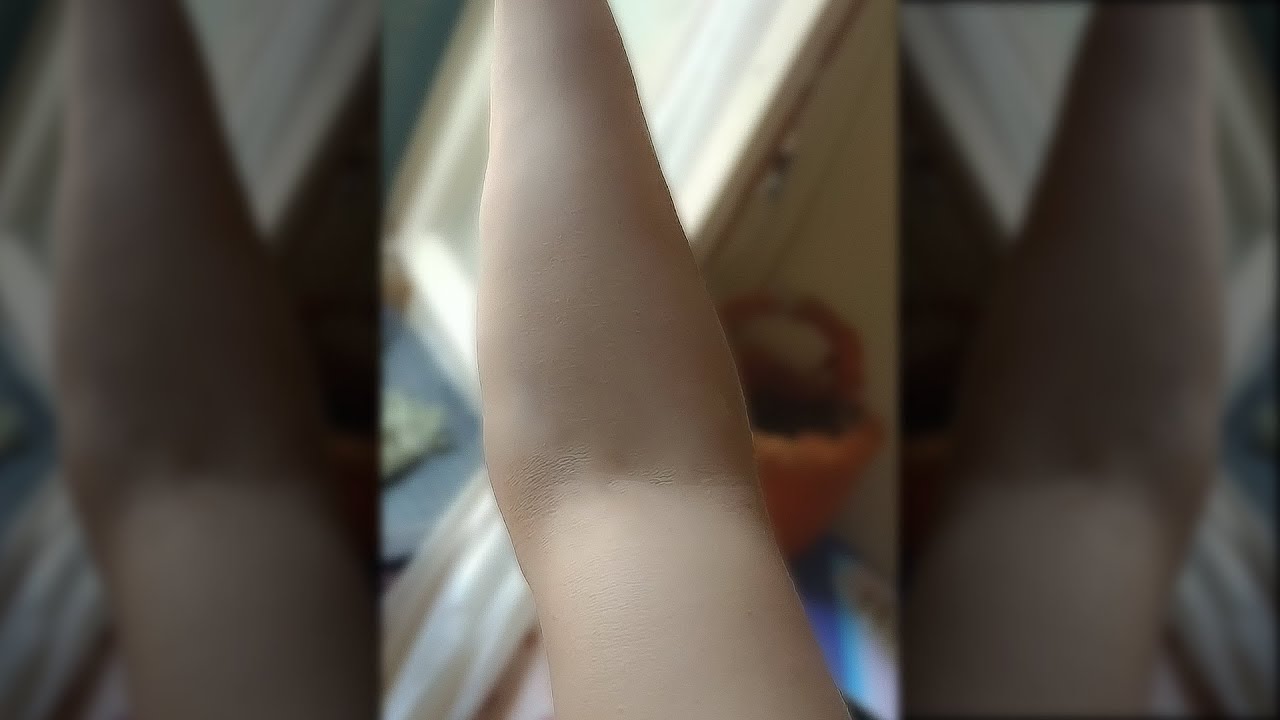 From 0 Veins To Over 9000 In 5 Seconds.. 😐😐😐