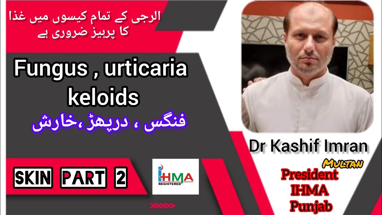 Fungus  ||  Urticaria || keloids  by Dr Kashif Imran Sahab
