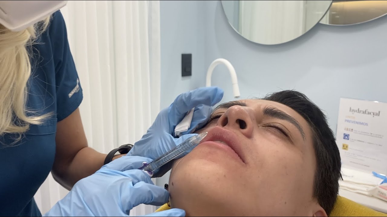 ME INYECTO LOS LABIOS