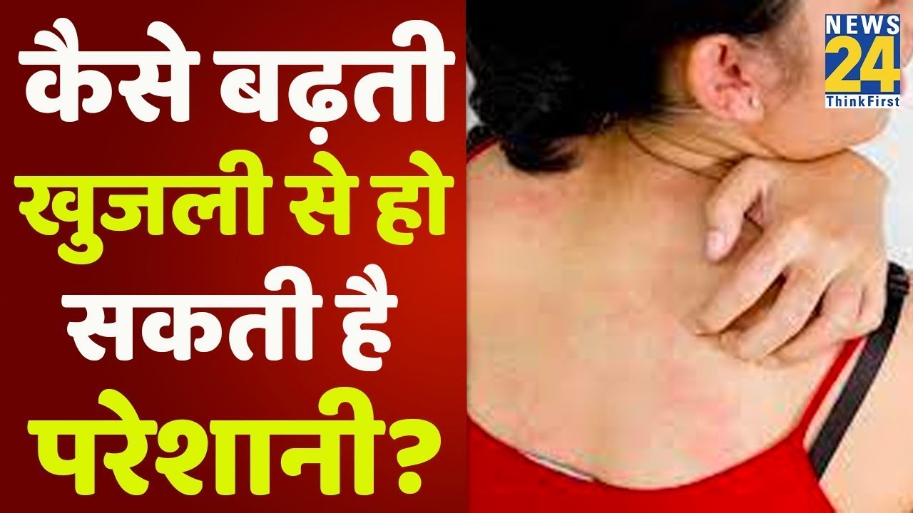 Sanjeevani: क्या आप भी हैं खुजली से परेशान ? Dr. Pratap Chauhan से जानिए क्या खाएं, क्या ना खाएं ?