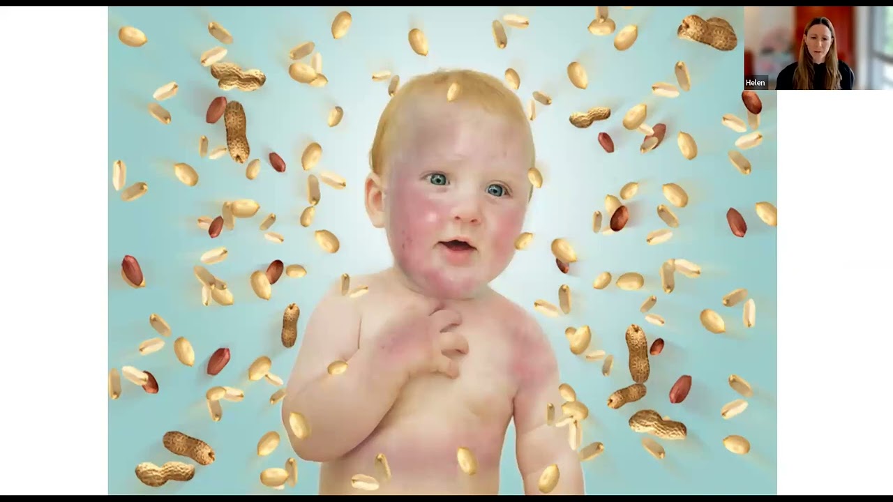Child Food Allergies & Eczema: Insights with Dr. Helen Brough during the Weaning Week