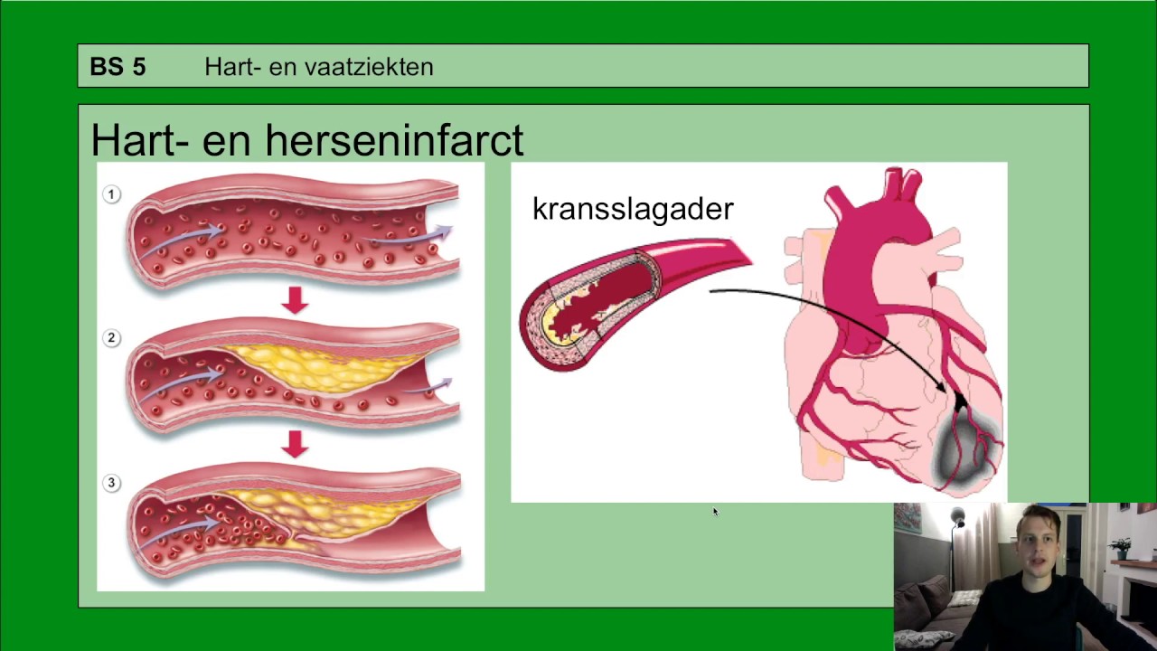 Basisstof 5 Hart- en vaatziekten
