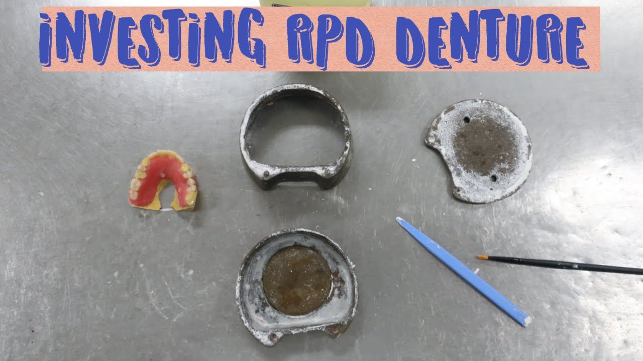 Removable Partial Denture processing