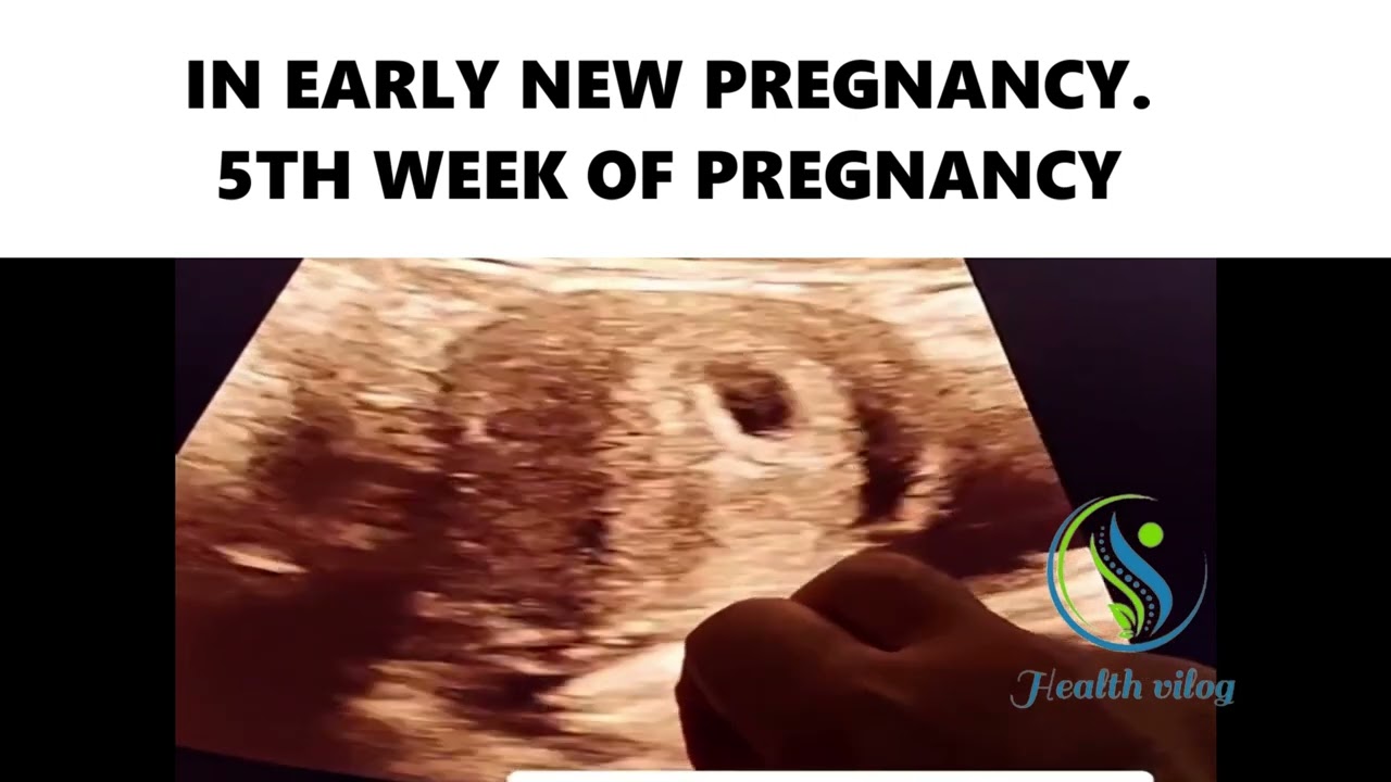 IN EARLY NEW PREGNANCY. 5TH WEEK OF PREGNANCY #ultrasound #baby #pregnancy #pregnancytest