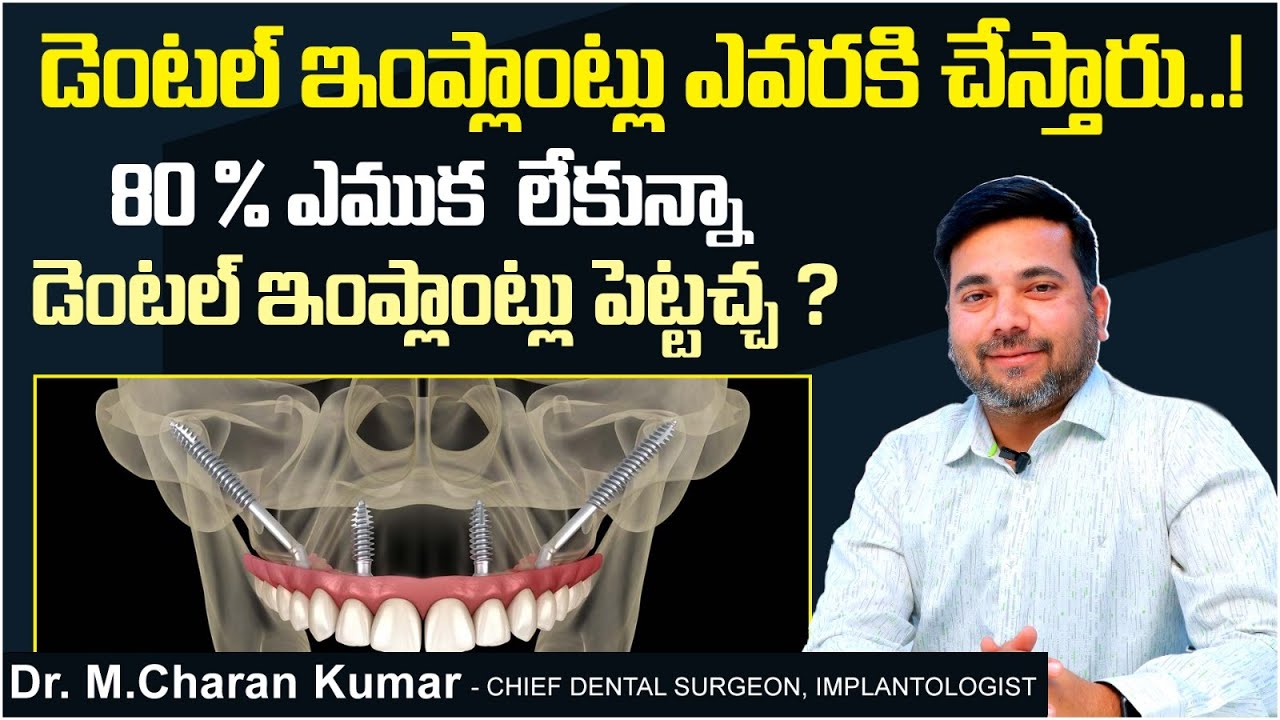 డెంటల్ ఇంప్లాంట్లు || Dental Implants in Patients With Severe Bone Loss || Eledent Dental Hospitals