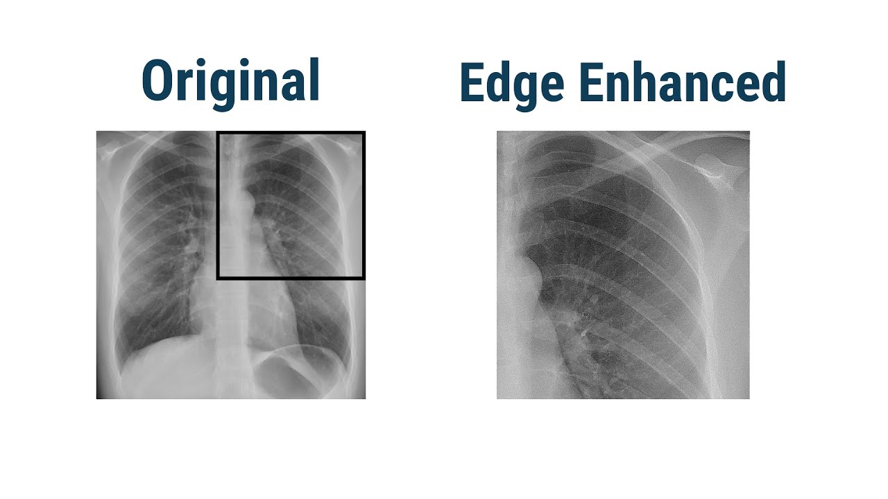 Image Filters (Smoothing Filter, Edge Enhancement Filters)