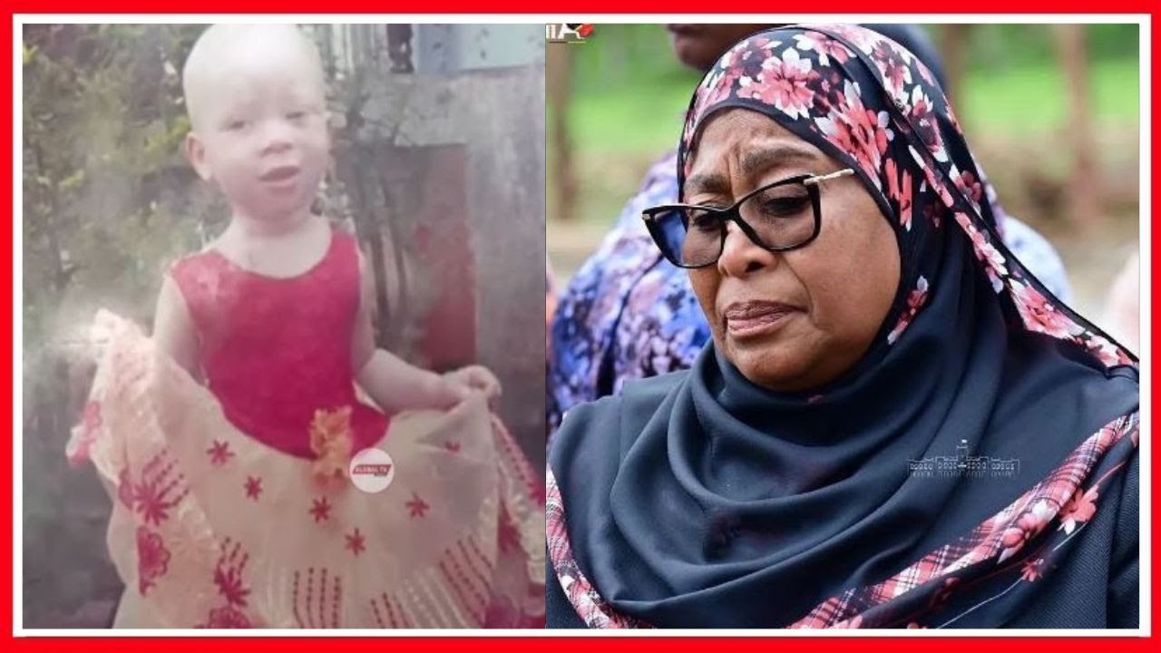 RAIS SAMIA AMEONA MTOTO ALBINO ALIYEUAWA KINYAMA - ASIMAMISHA WATUMISHI SEKUNDE KUMWOMBEA...