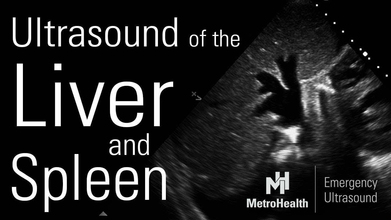 Ultrasound of the Liver & Spleen