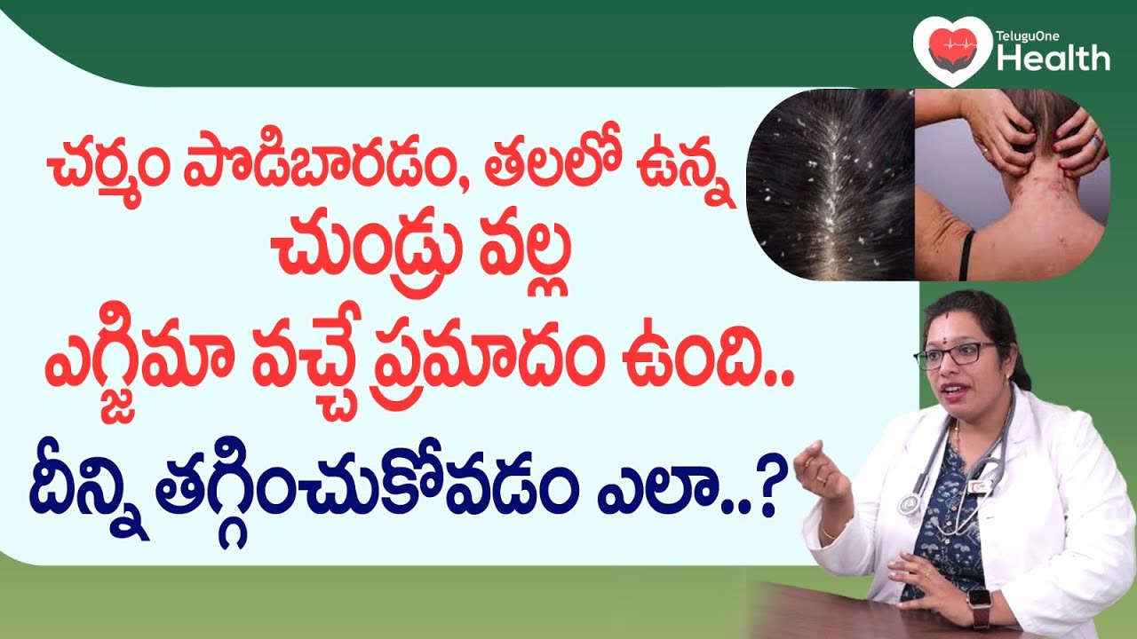 Eczema | చర్మం పొడిబారడం, తలలో ఉన్న చుండ్రు వల్ల ఎగ్జిమా... Dr. Laxmi Purnima | TeluguOne Health