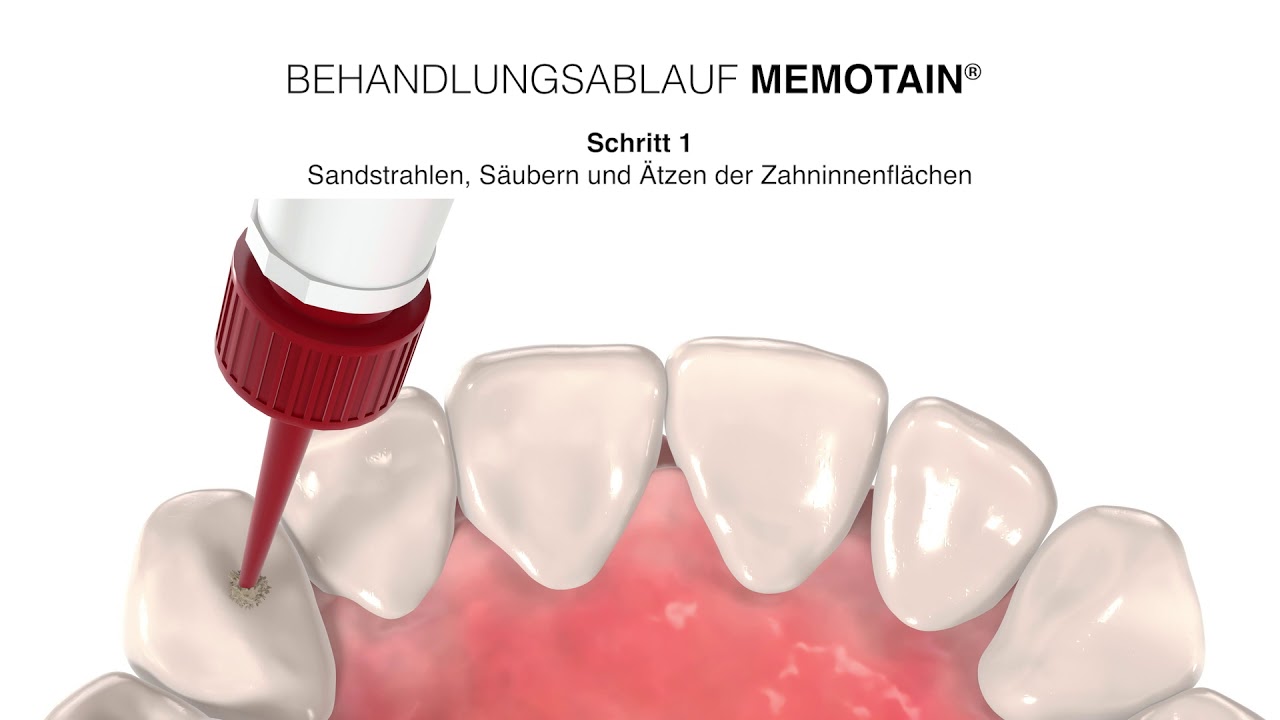 Memotain Klebeanleitung 2019