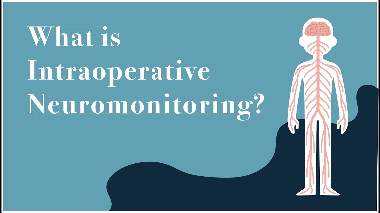 What is IONM?