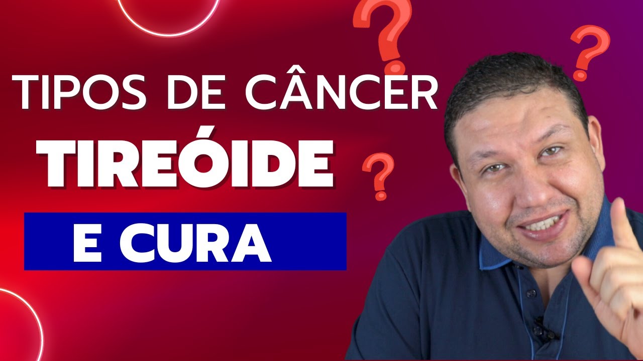 CÂNCER DE TIREÓIDE - Tipos de câncer de tireóide e chance de cura.