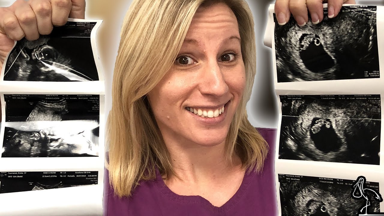 How Many Ultrasounds Are Done During Pregnancy?