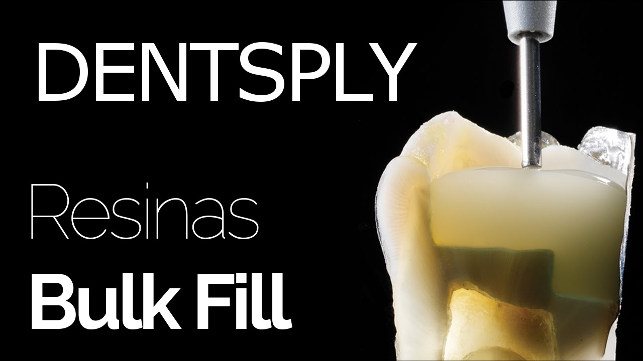 Dentsply - Resinas Bulk Fill