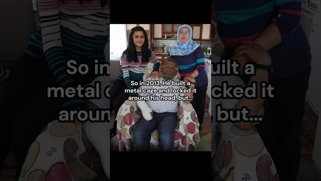 This man did the most unthinkable thing to quit his smoking habit #realstory #quitsmoking