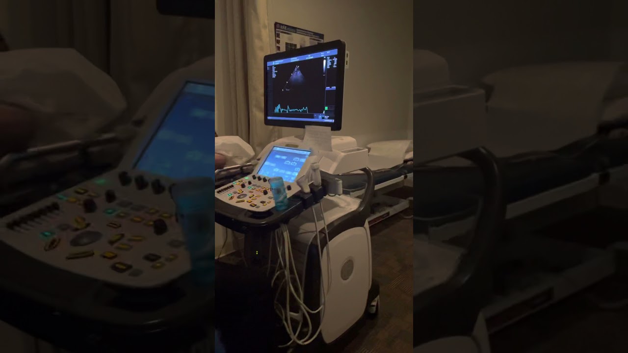 GE vivid stress echo pt. 1