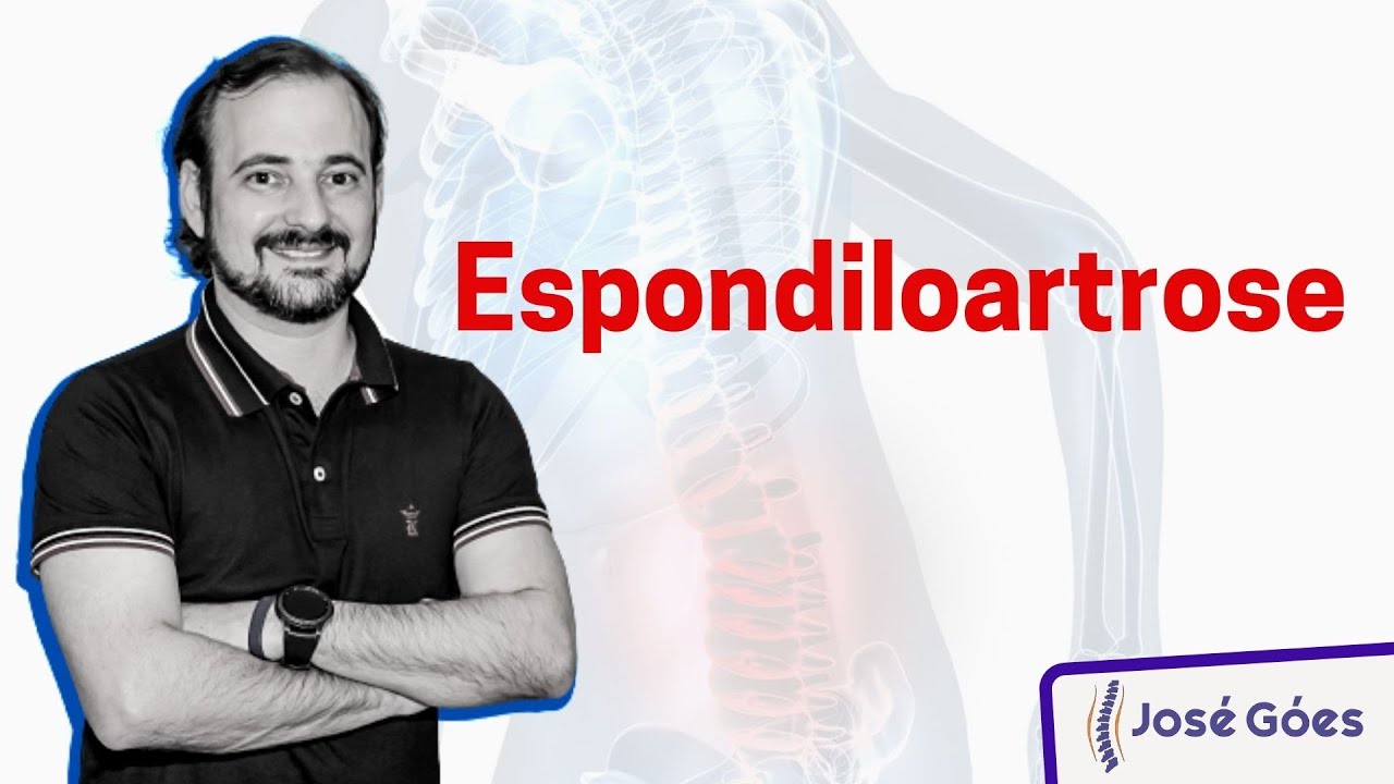 Espondiloartrose | José Góes
