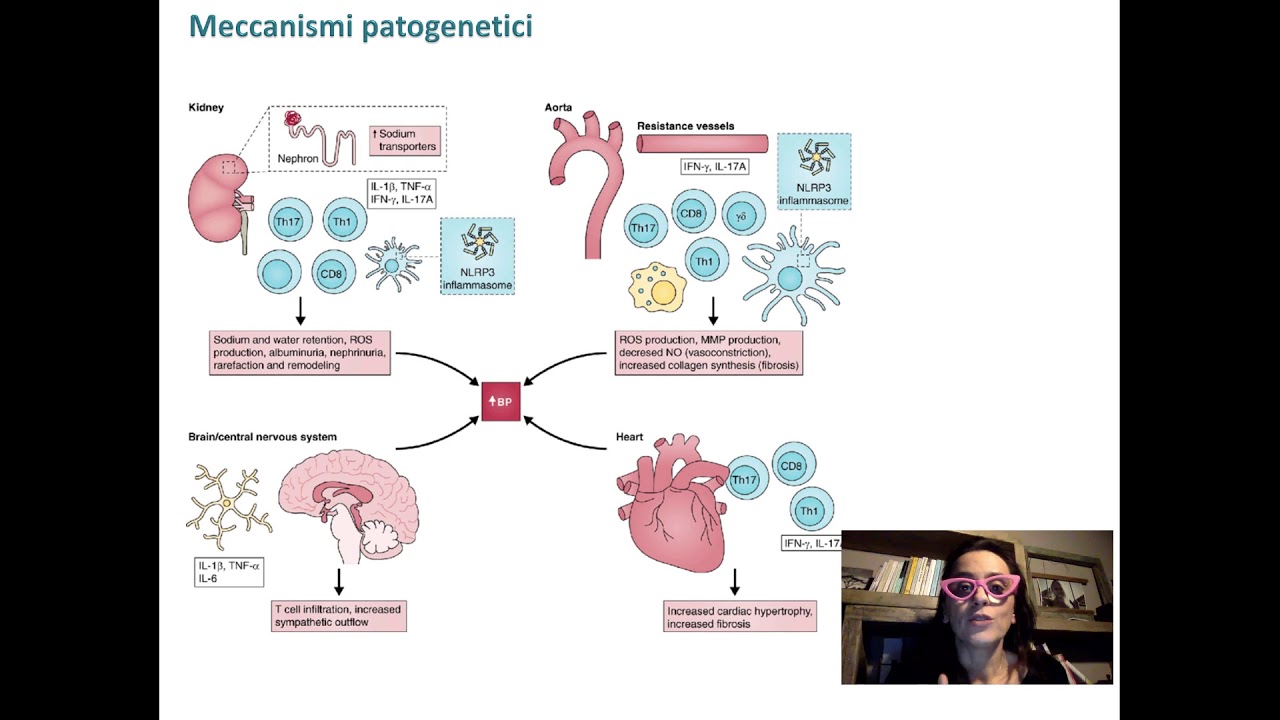 Trattamento delle emergenze ipertensive in DEA   dott ssa Elena Daghini