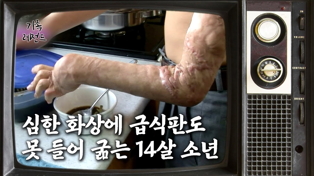 ['가족' 레전드 14편③] 심한 화상에 급식판도 못 들어 굶는 14살 소년