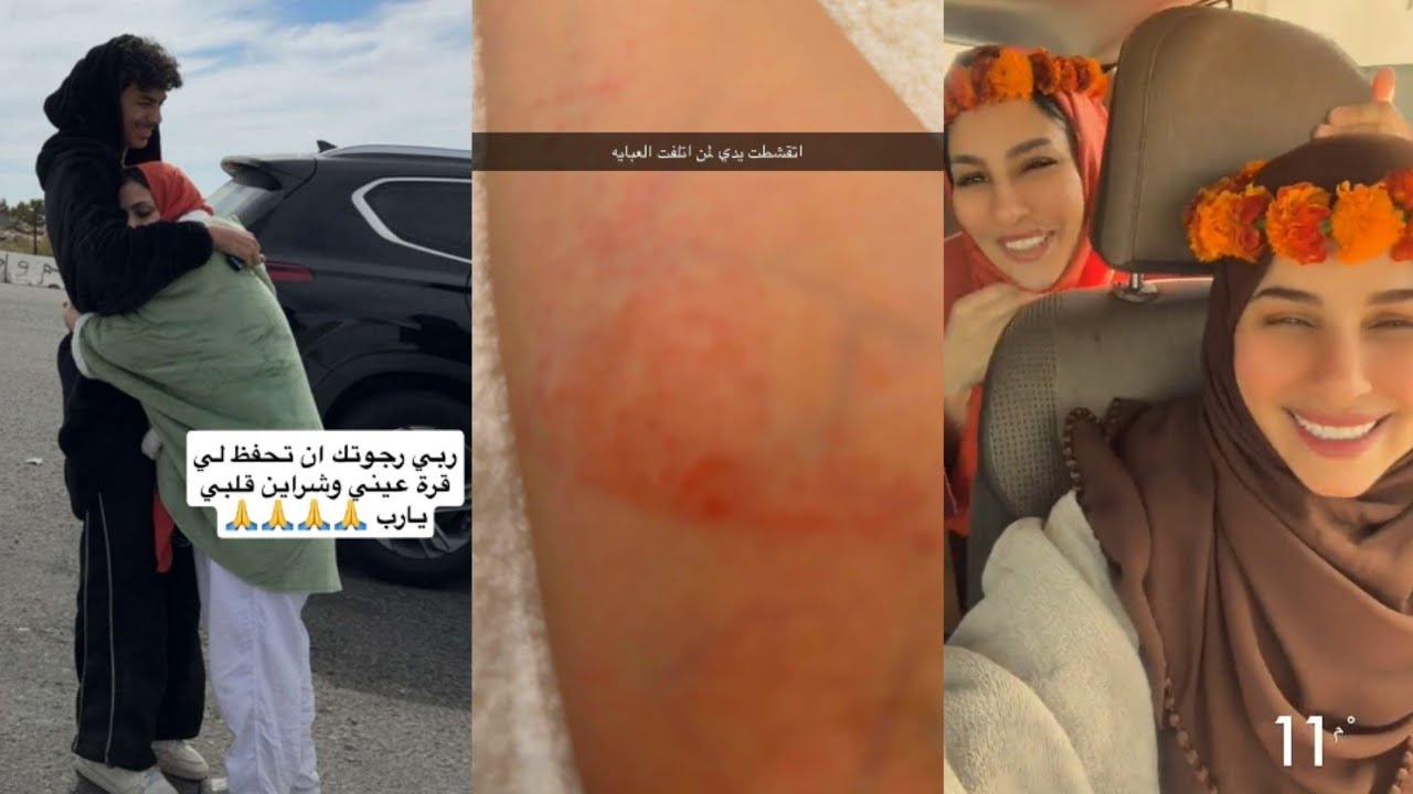 الجمال اليماني عقد ورد الطائفي✨😍ركبت الدباب مع أخوها صدمت وجرحت يدها😱😭تخاف من حشرات الجبل😬حلا حلواني