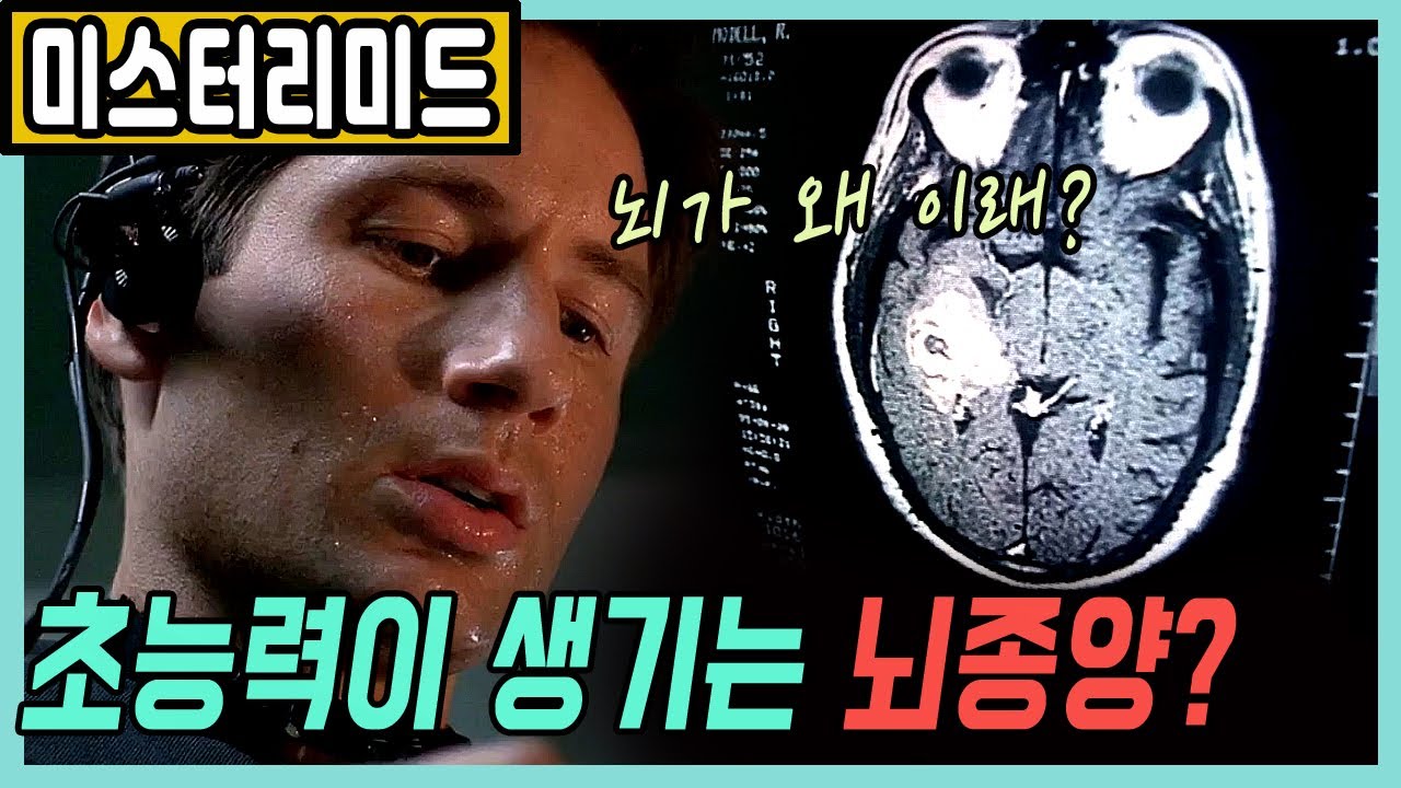 👍뇌종양 때문에 초능력이 생긴 연쇄살인마🎬[미스터리미드_더빙판_XFILE]:결말포함