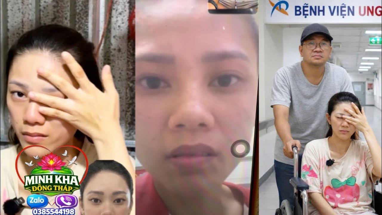 Kiều báo tin tiểu tiện ko nhận thức rồi phải làm sao.