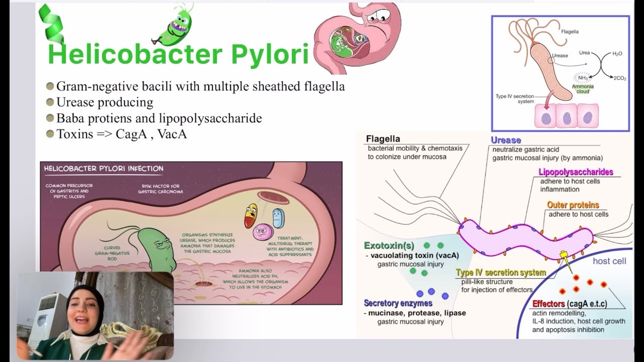 H pylori . All you need to know in 30 minutes