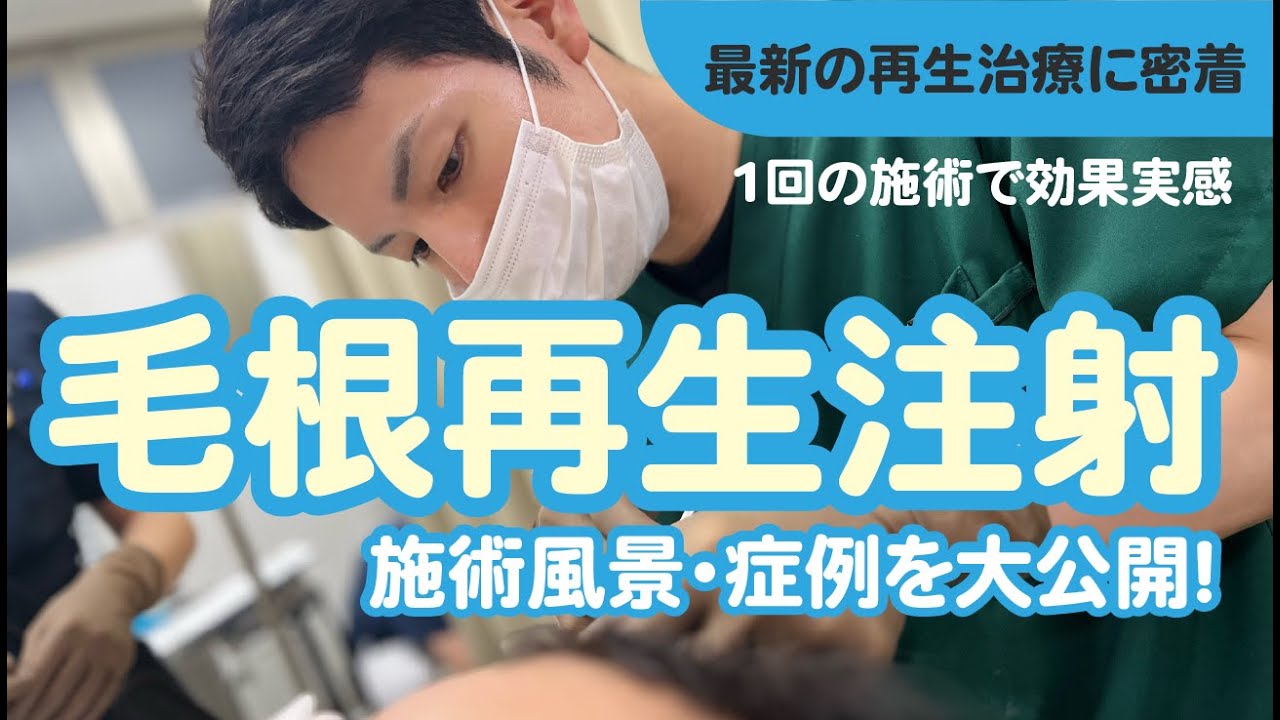 【施術に密着📷】毛根再生注射の施術風景＆症例写真大公開！