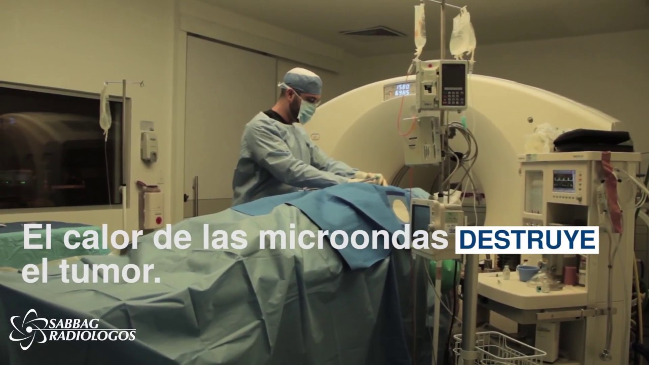 Sabbag Radiólogos- Ablación por Microondas para la cura del cáncer