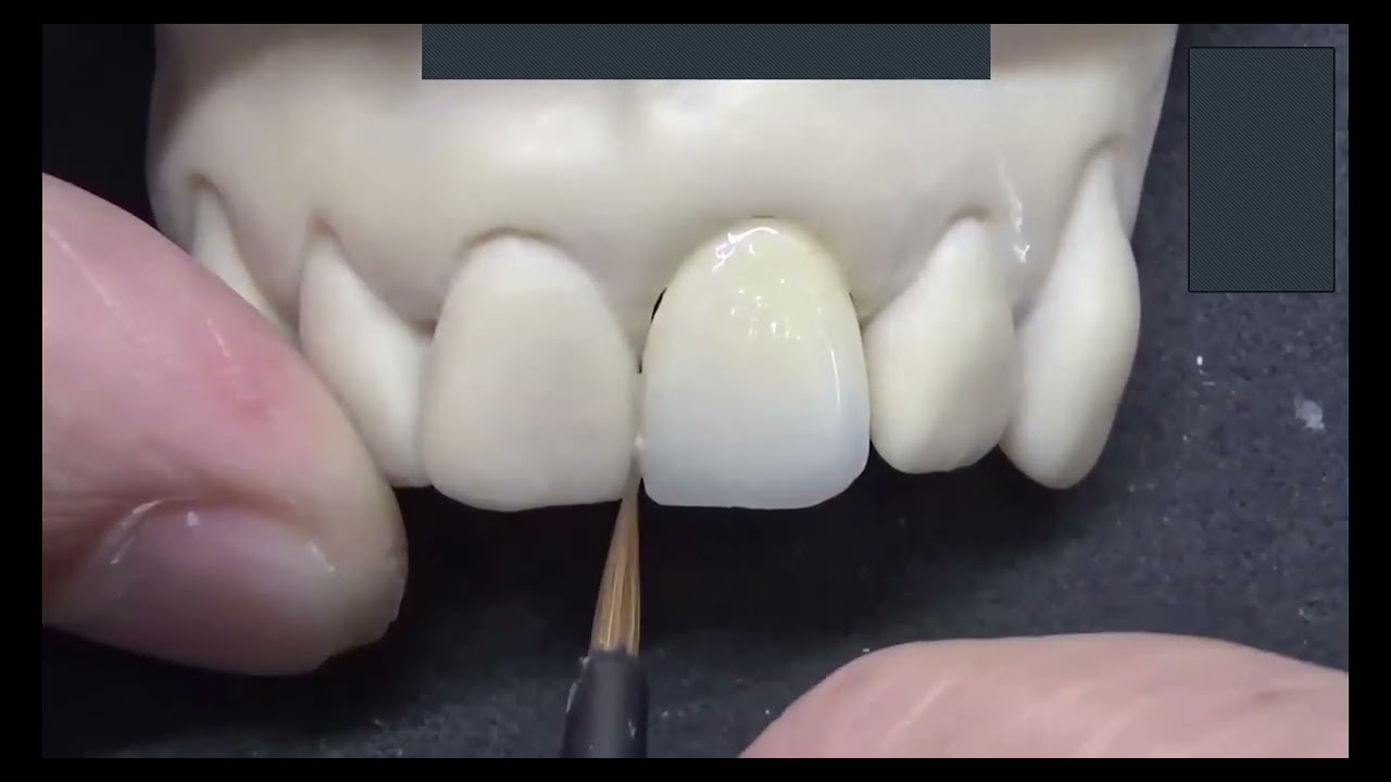 Biomic Stain & Glaze: Elevate Your Esthetics - Presented by Aidite & Nowak Dental Supplies