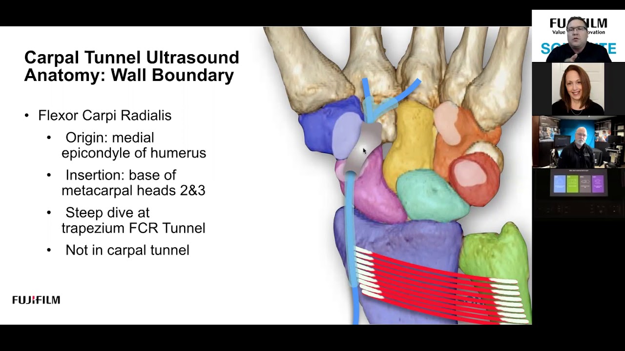 Webinar: Carpal Tunnel Evaluation