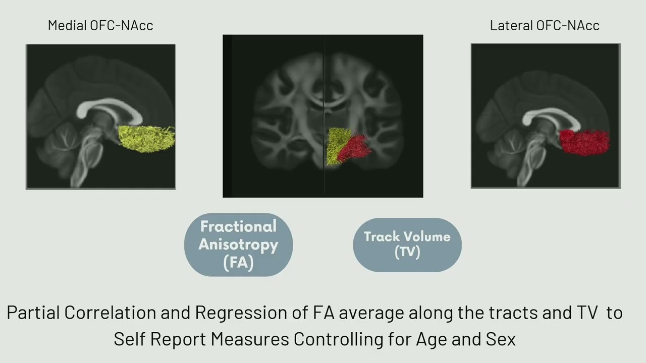 OHBM 2025 | Oral Session | Santiago Mezzano | Mapping Reward Circuits: Orbitofrontal-Accumben Trac…