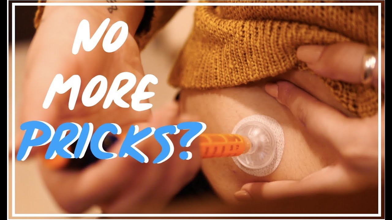 IPORT ADVANCE | no more pricks? 💉