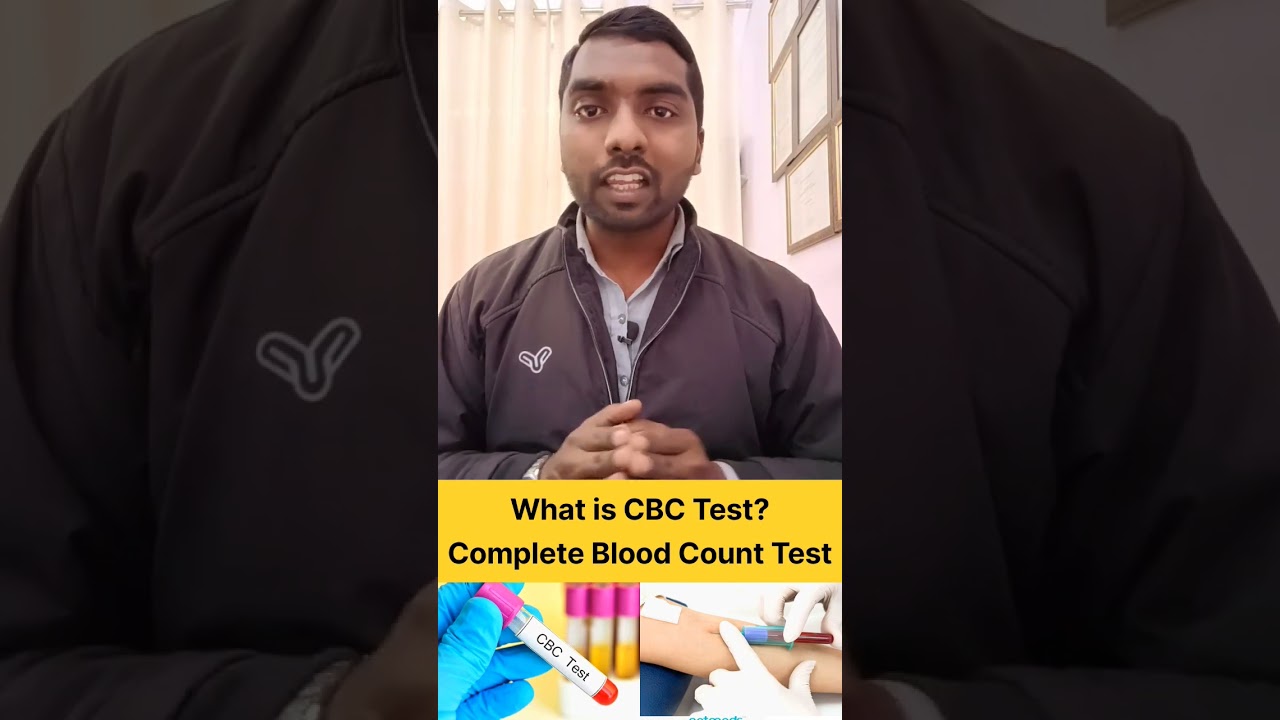 What is CBC Test (Complete Blood Count Test) by Shubham Kushwaha 