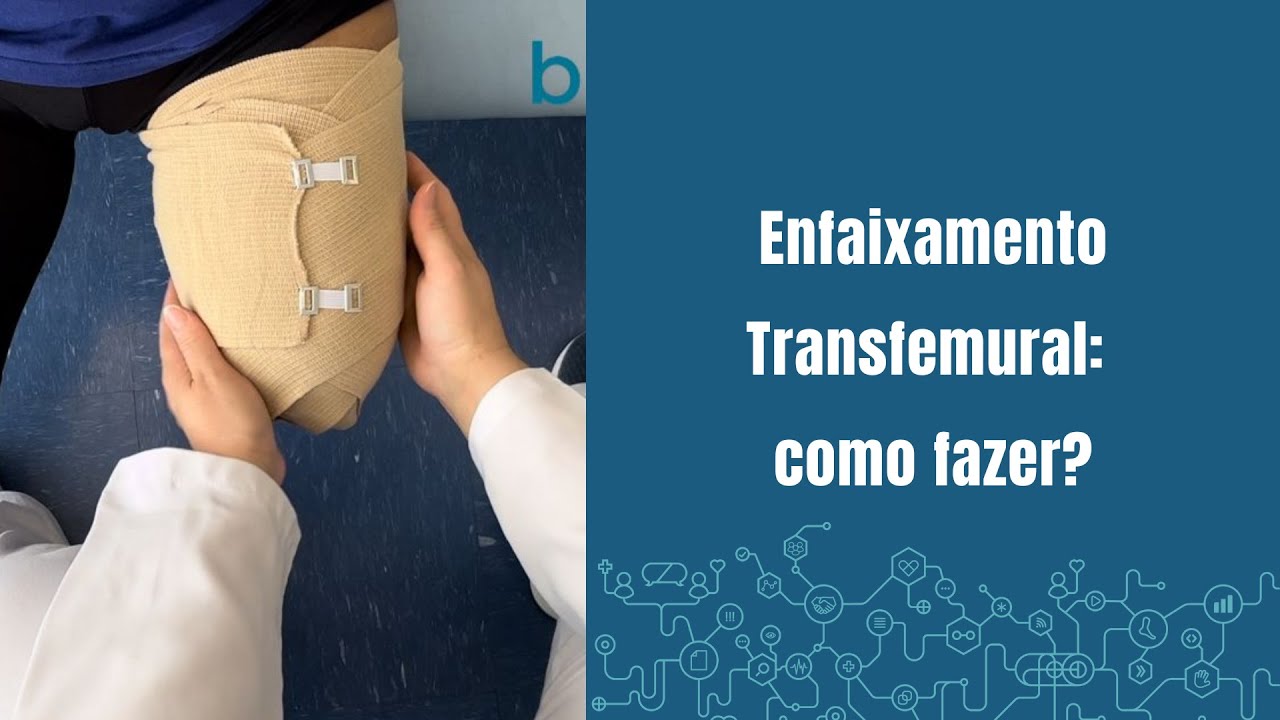 Enfaixamento Transfemural: como fazer?