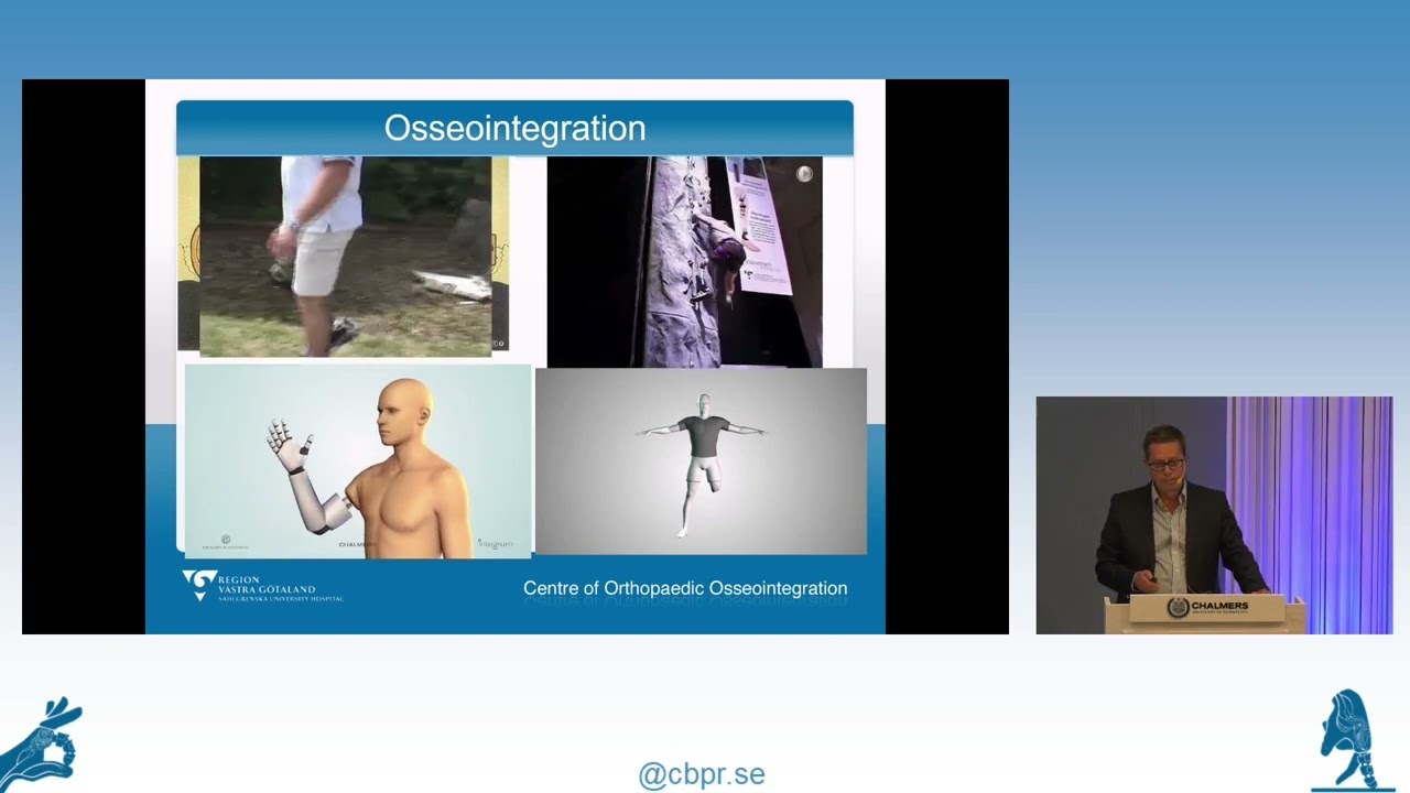 CBPR Inaugural Symposium - Assoc. Prof. Rickard Br&aring;nemark: Osseointegration