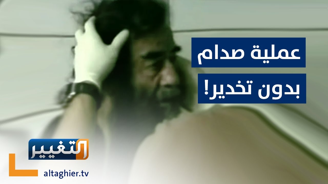 ما العملية التي اجرتها امريكا لصدام حسين بدون تخدير اثناء اعتقاله؟