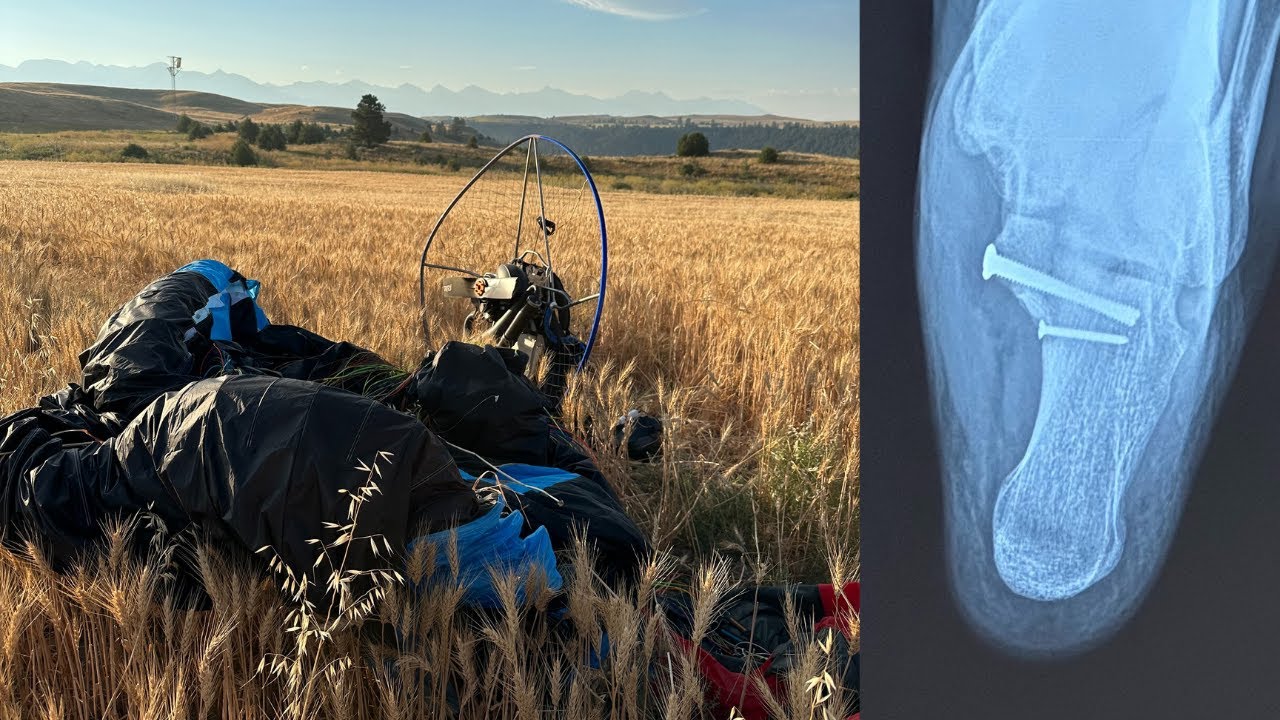 I Crashed My Paramotor & Broke My Heel Bone.