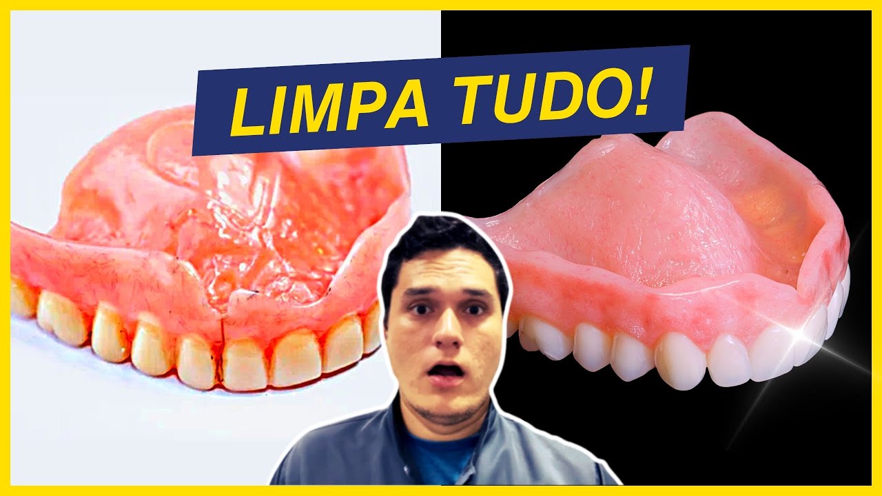 Aprenda a higienizar prótese e dentadura do jeito certo!