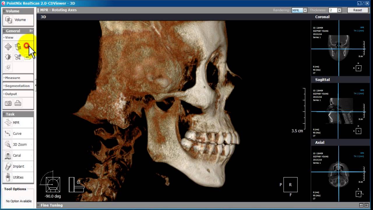 Software de Tomografía dental : Real Scan 2.0 -Herramientas generales